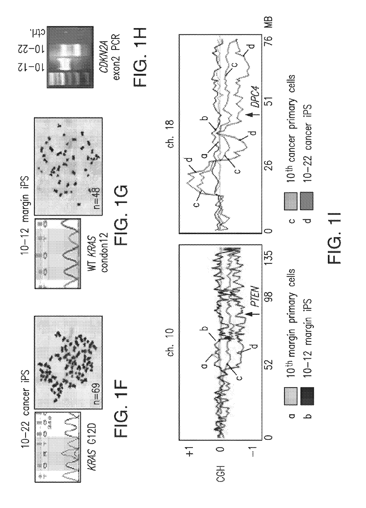 Methods for diagnosing pancreatic cancer