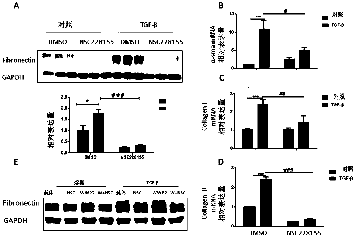 Application of NSC228155 in preparation of drug for preventing and treating chronic renal fibrosis