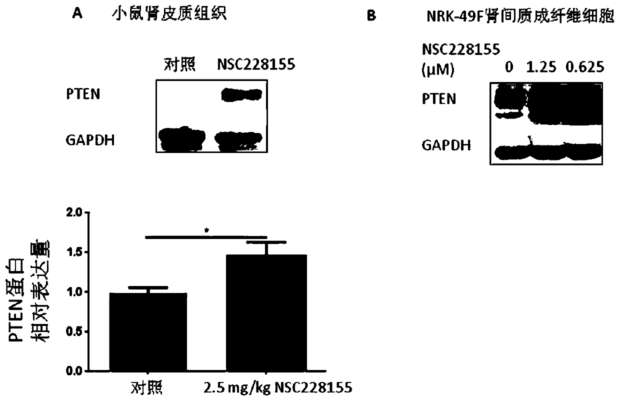 Application of NSC228155 in preparation of drug for preventing and treating chronic renal fibrosis