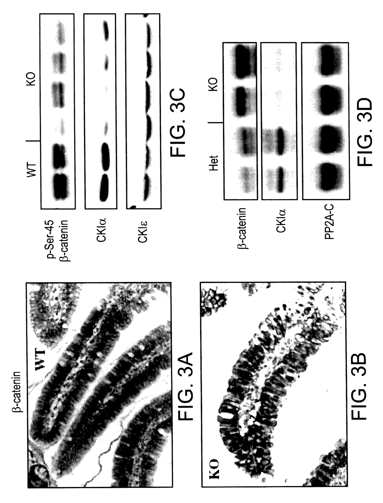 Methods of killing cells and use of same in prevention and treatment of cancer