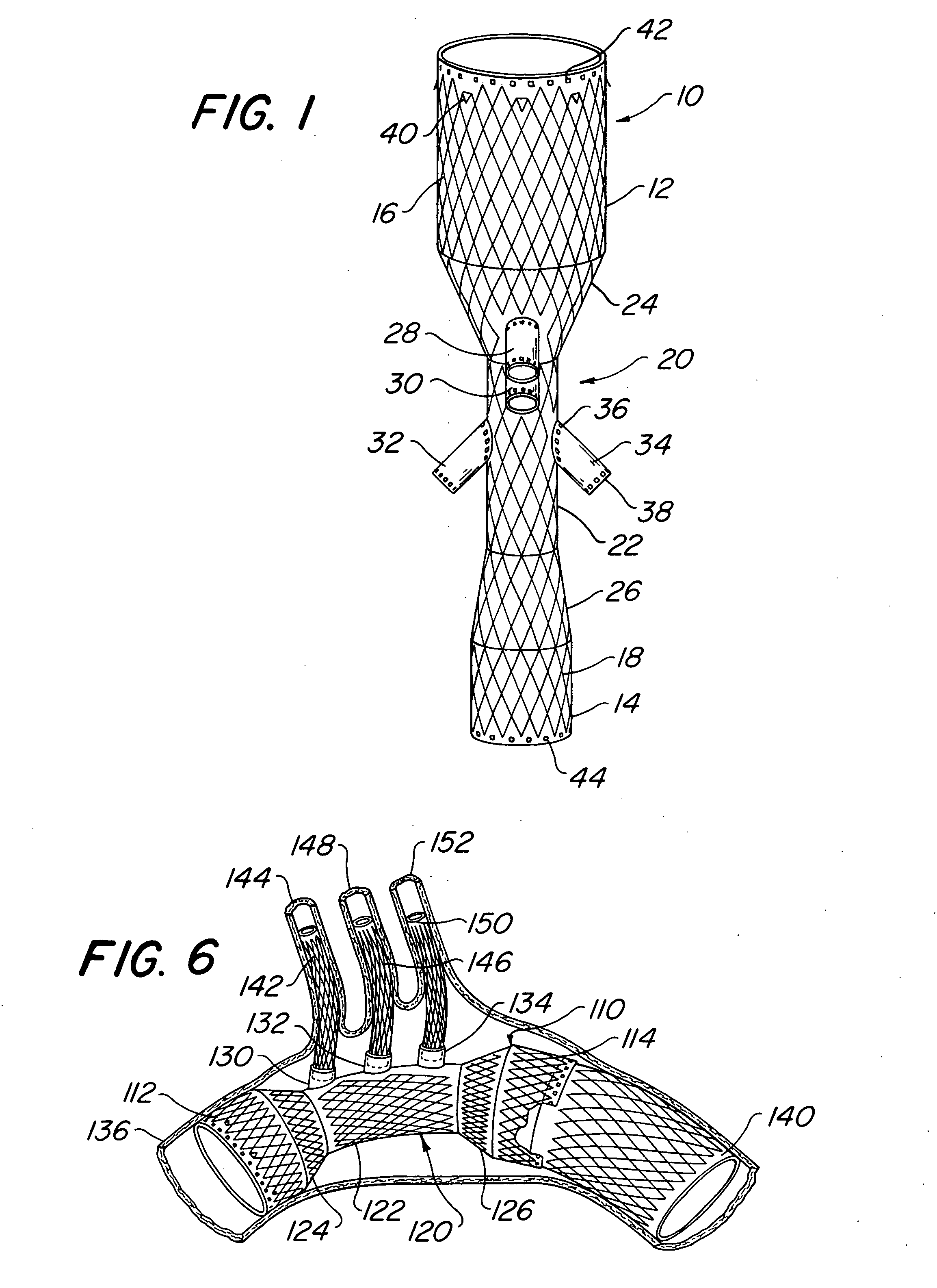 Endovascular prosthesis, system and method