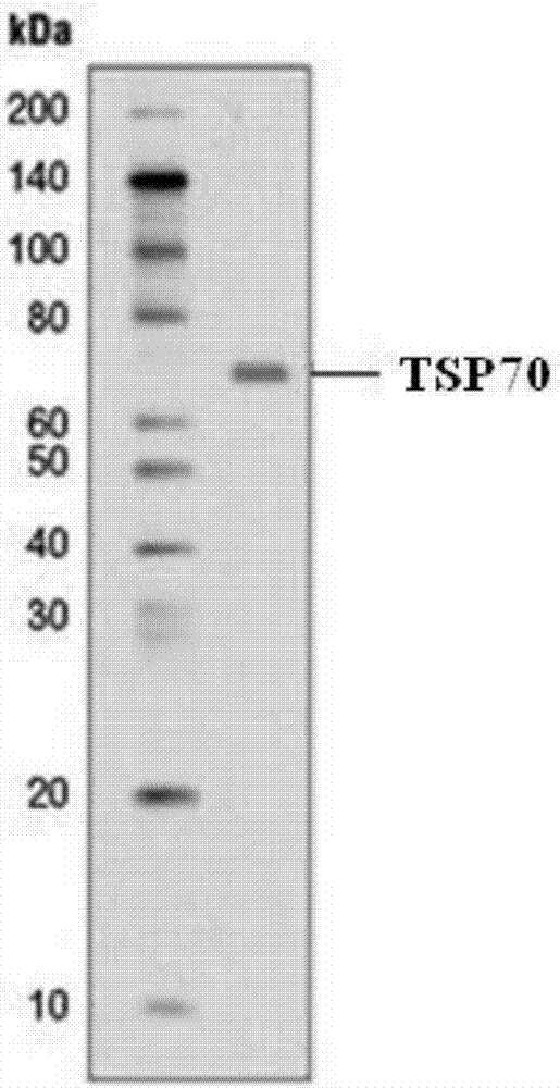 Tumor-specific antigen TSP70 and application thereof