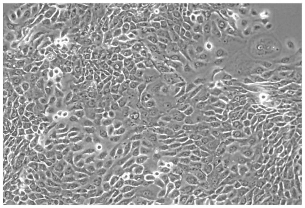 A kind of human normal corneal epithelial cell and its application