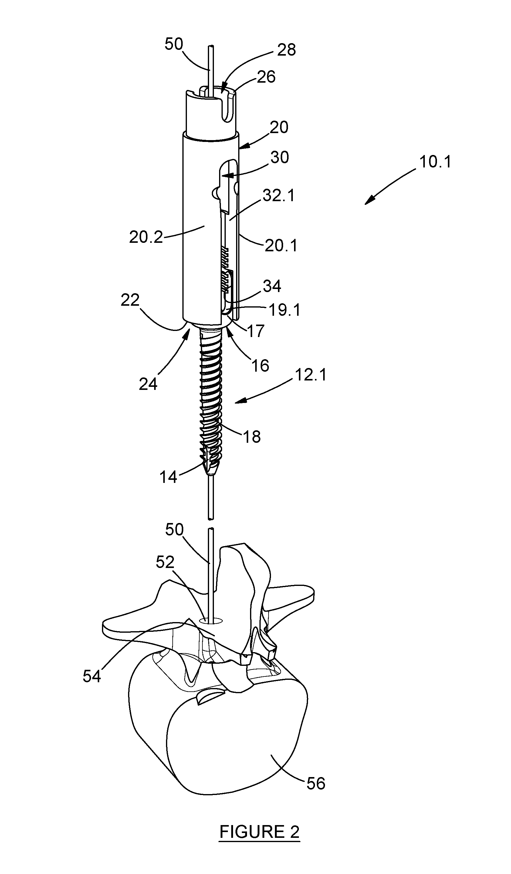 Pedicle mountable retractor system