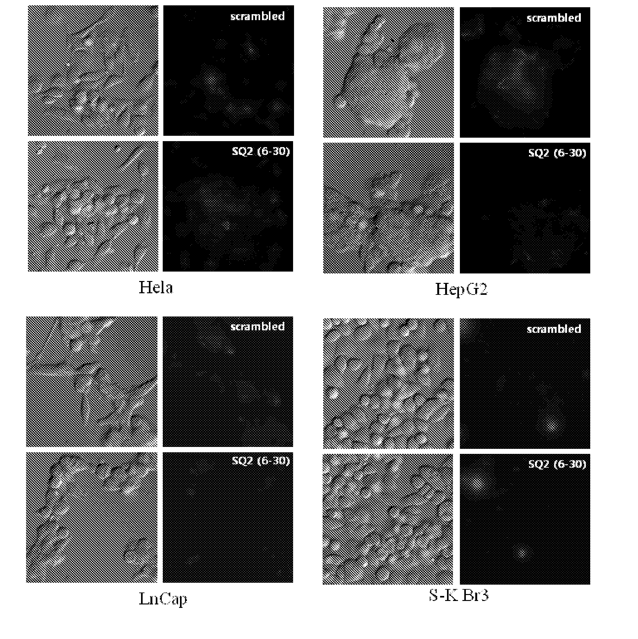 Nucleic acid aptamer capable of binding specifically to pancreatic cancer cells or tissues and use thereof