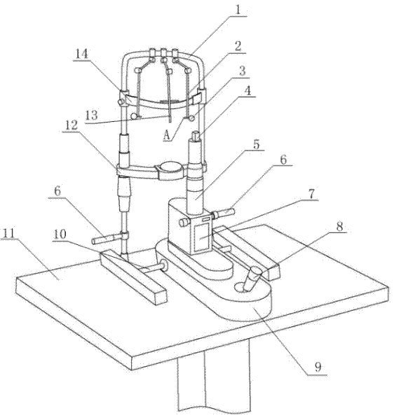 Measurement method of exophthalmos, instrument and application of instrument