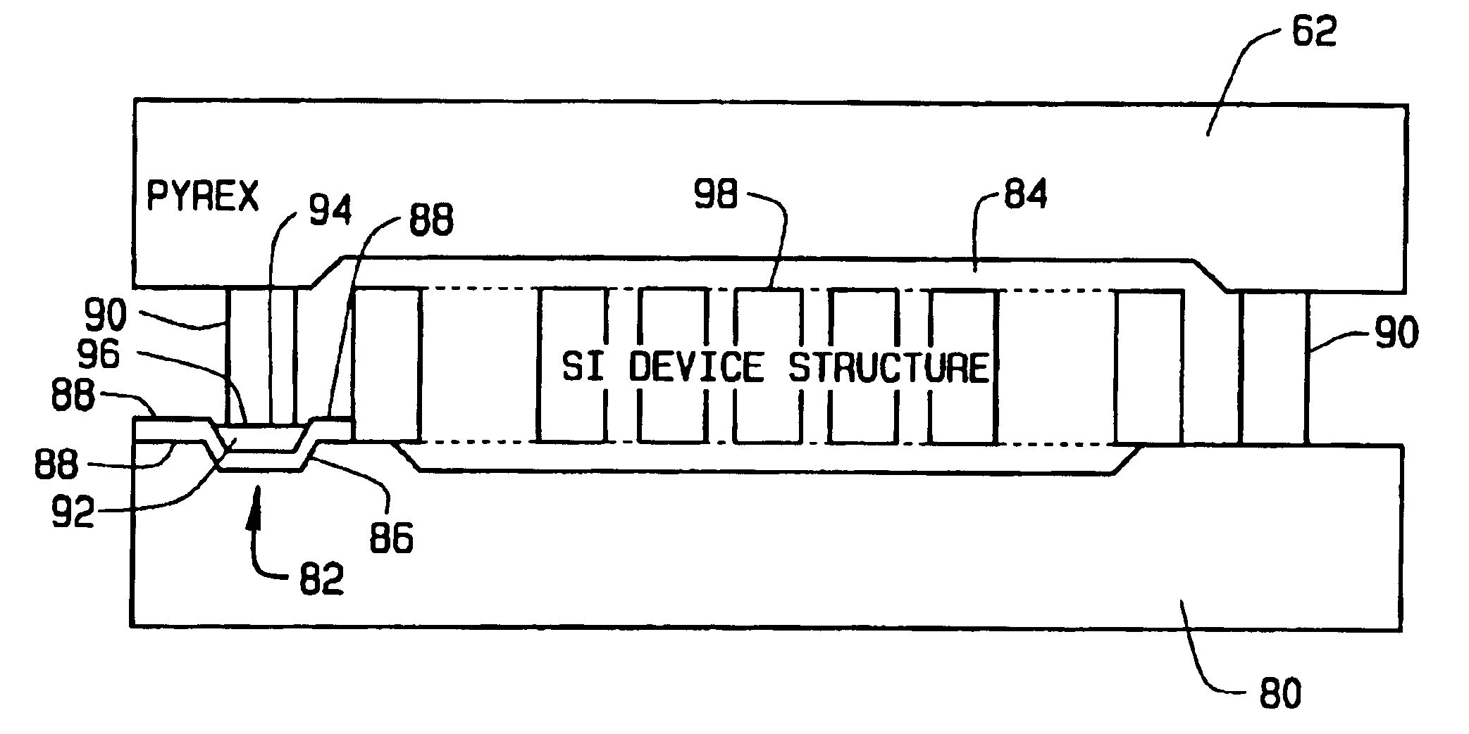 Systems for buried electrical feedthroughs in a glass-silicon MEMS process