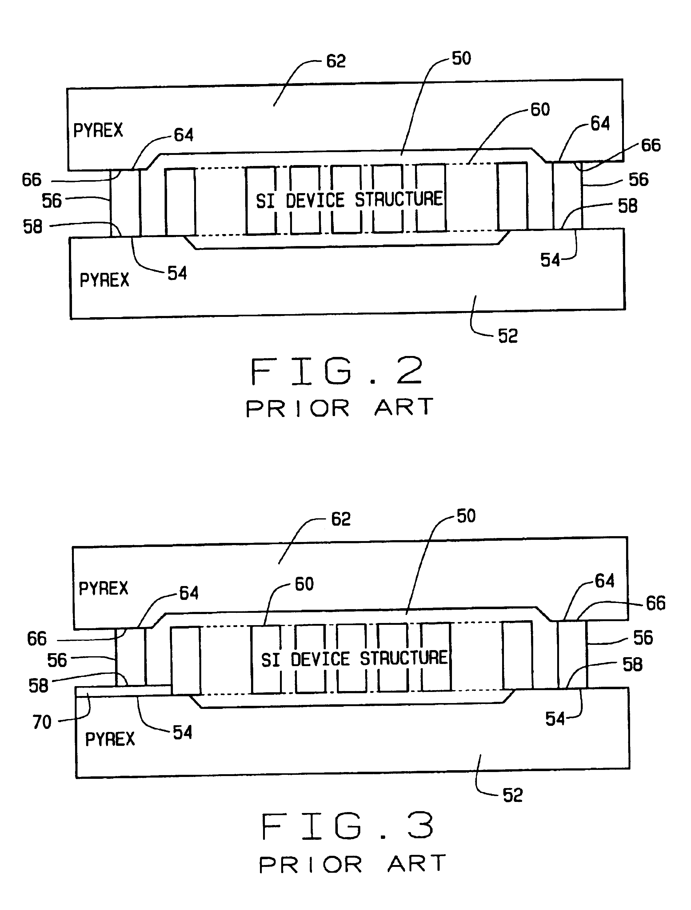 Systems for buried electrical feedthroughs in a glass-silicon MEMS process