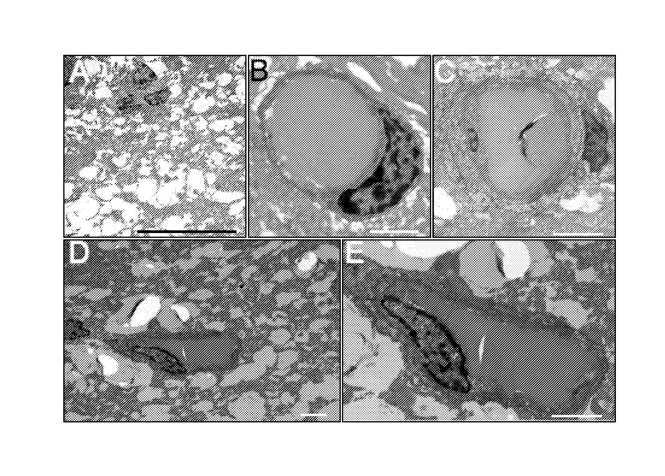 Method for treating chronic nerve tissue injury using a cell therapy strategy