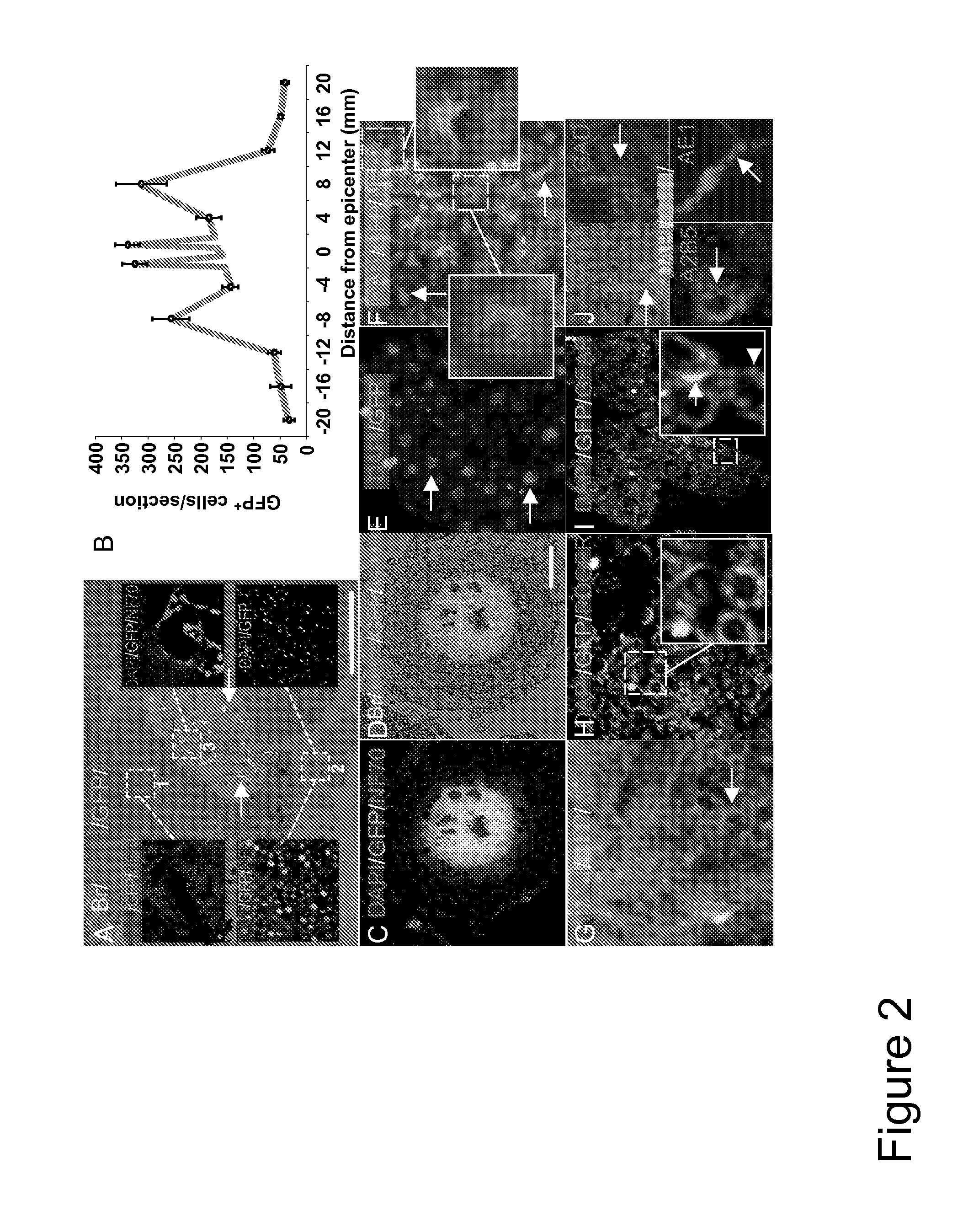 Method for treating chronic nerve tissue injury using a cell therapy strategy