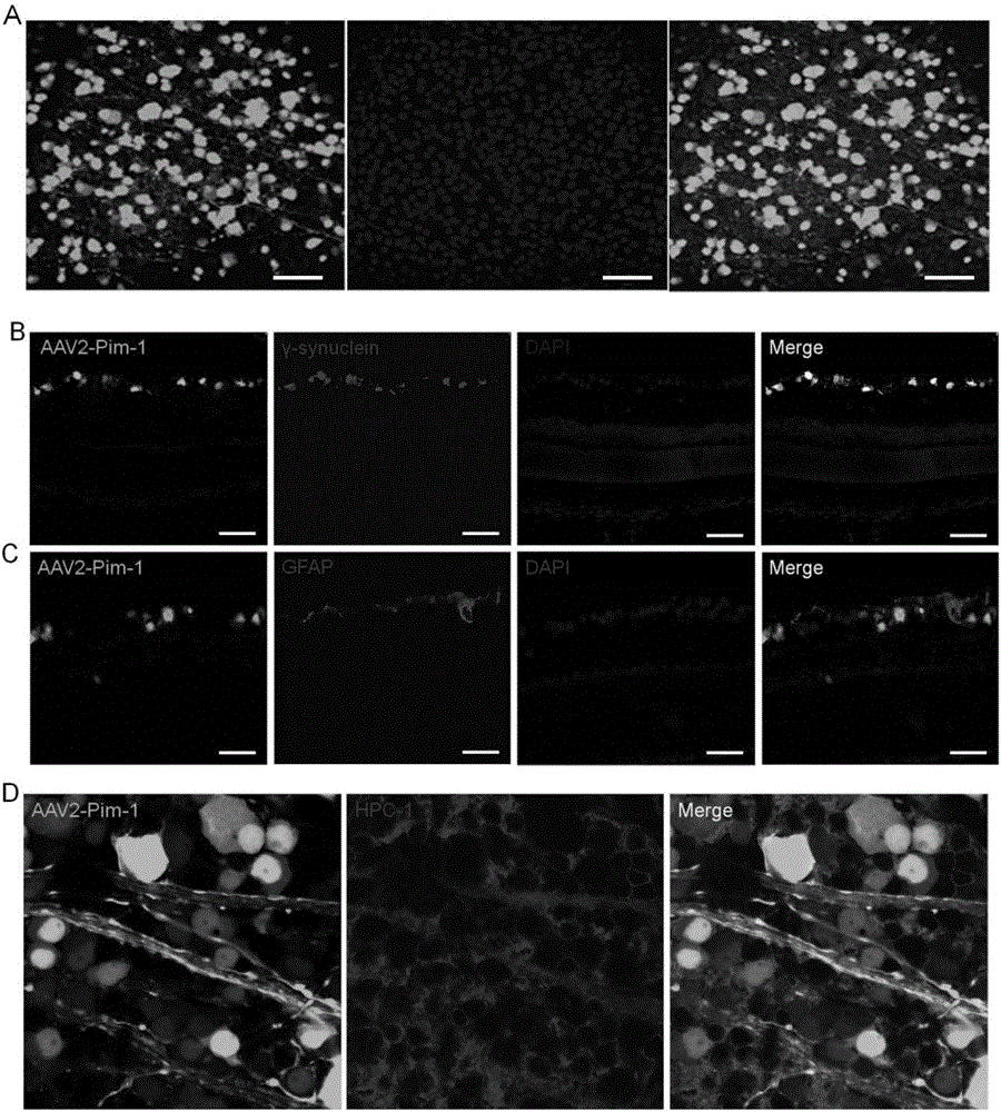 Pim-1 gene-containing adeno-associated virus 2 and application thereof to repairing of injured optic nerve