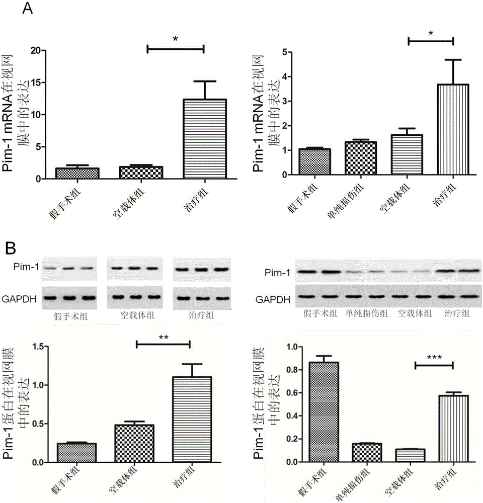 Pim-1 gene-containing adeno-associated virus 2 and application thereof to repairing of injured optic nerve