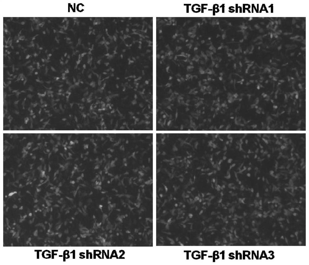 A shrna, carrier, kit and application thereof for knocking down tgf-β1