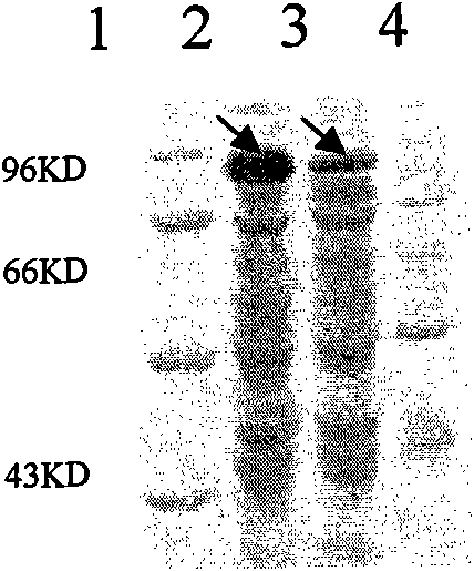Human papilloma virus (HPV) fusion protein, gene, carrier, strain, preparation method and application