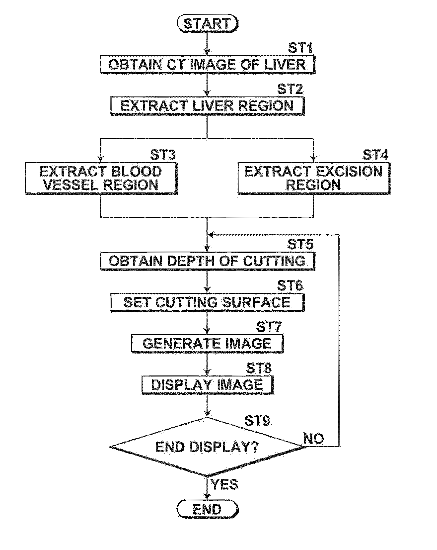 Surgery assistance apparatus, method and program