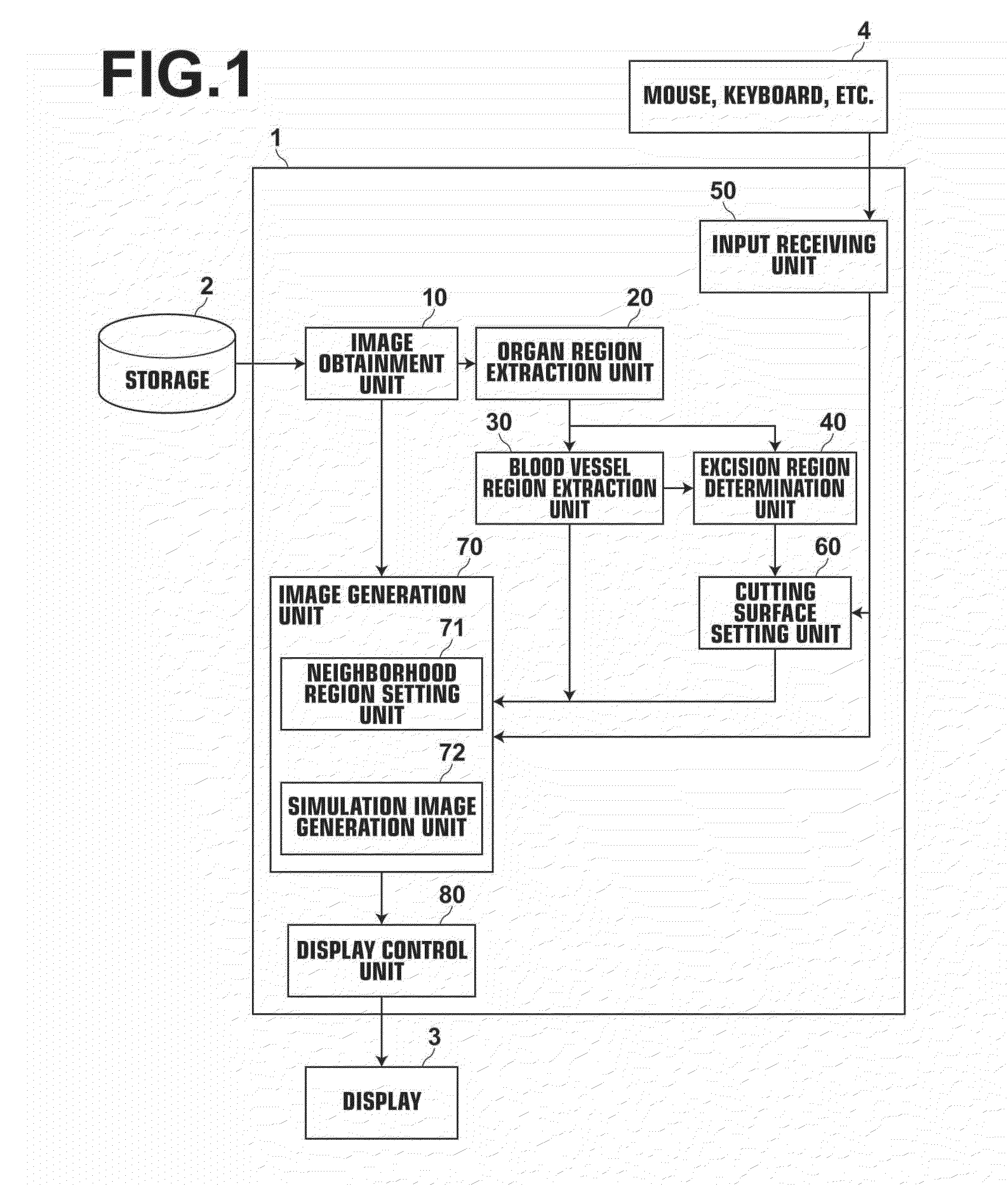Surgery assistance apparatus, method and program