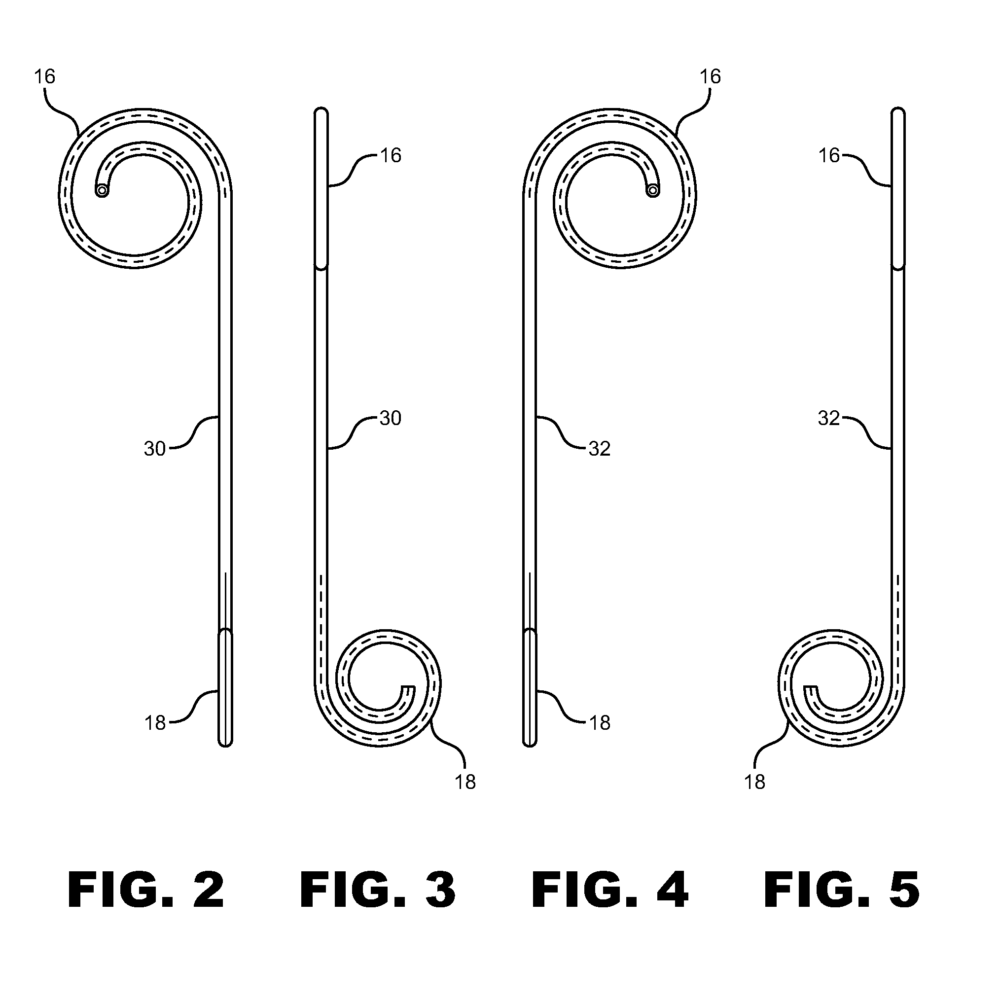 Anti-Refluxive and Trigone Sparing Internal Ureteral Stent