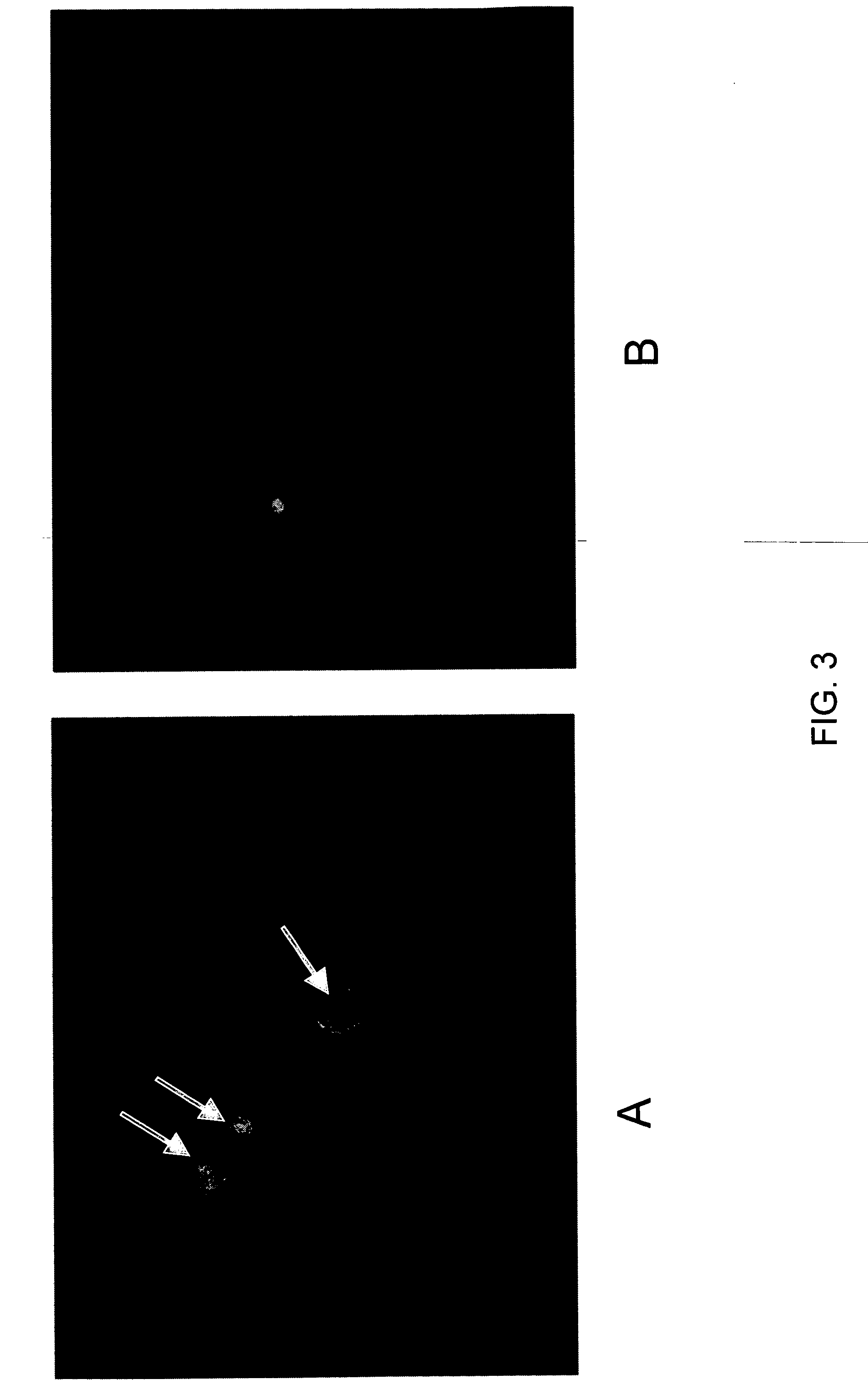 Systems and methods for silencing expression of a gene in a cell and uses thereof