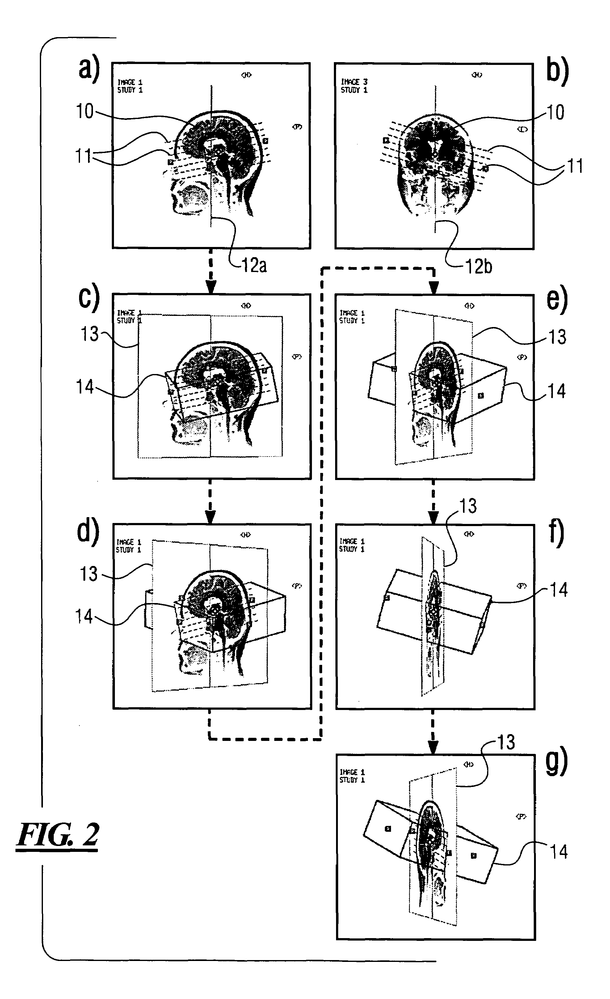 Apparatus for reference image rotation, and computer software product and method for reference image rotation