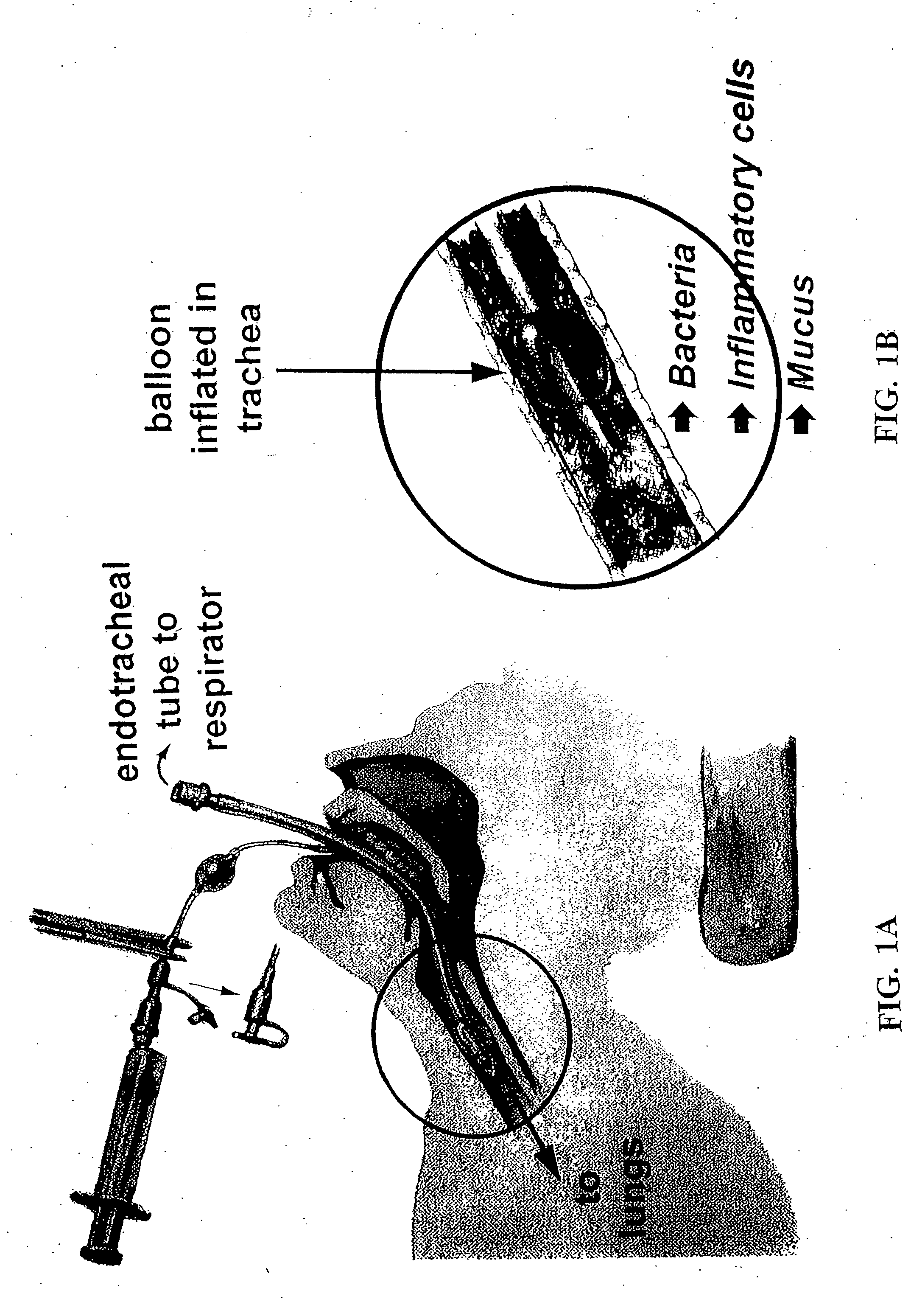 Methods, devices and formulations for targeted endobronchial therapy
