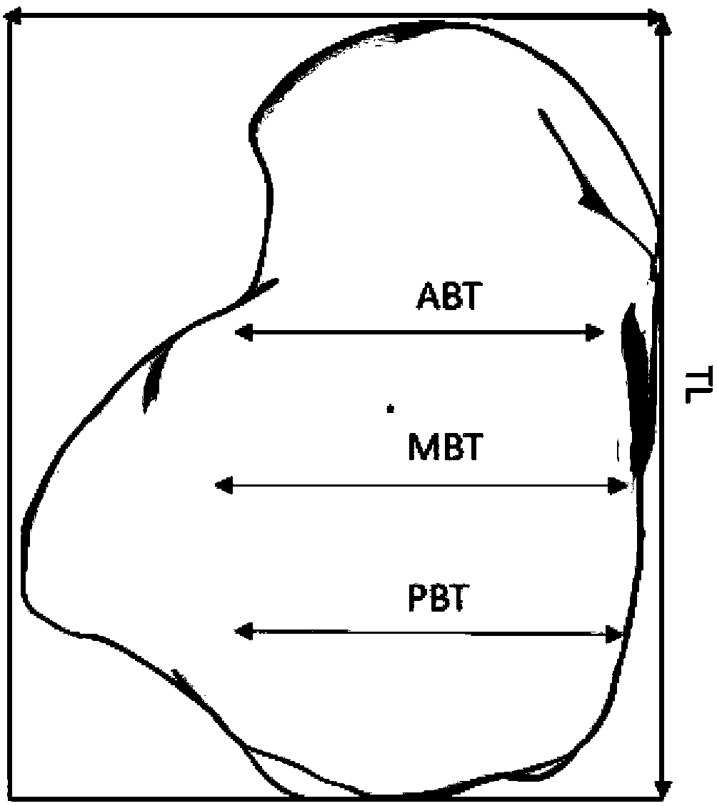 Astragalus prosthesis