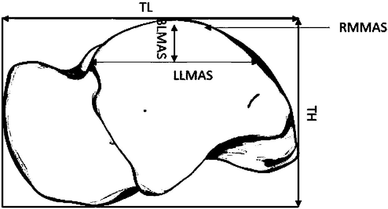 Astragalus prosthesis