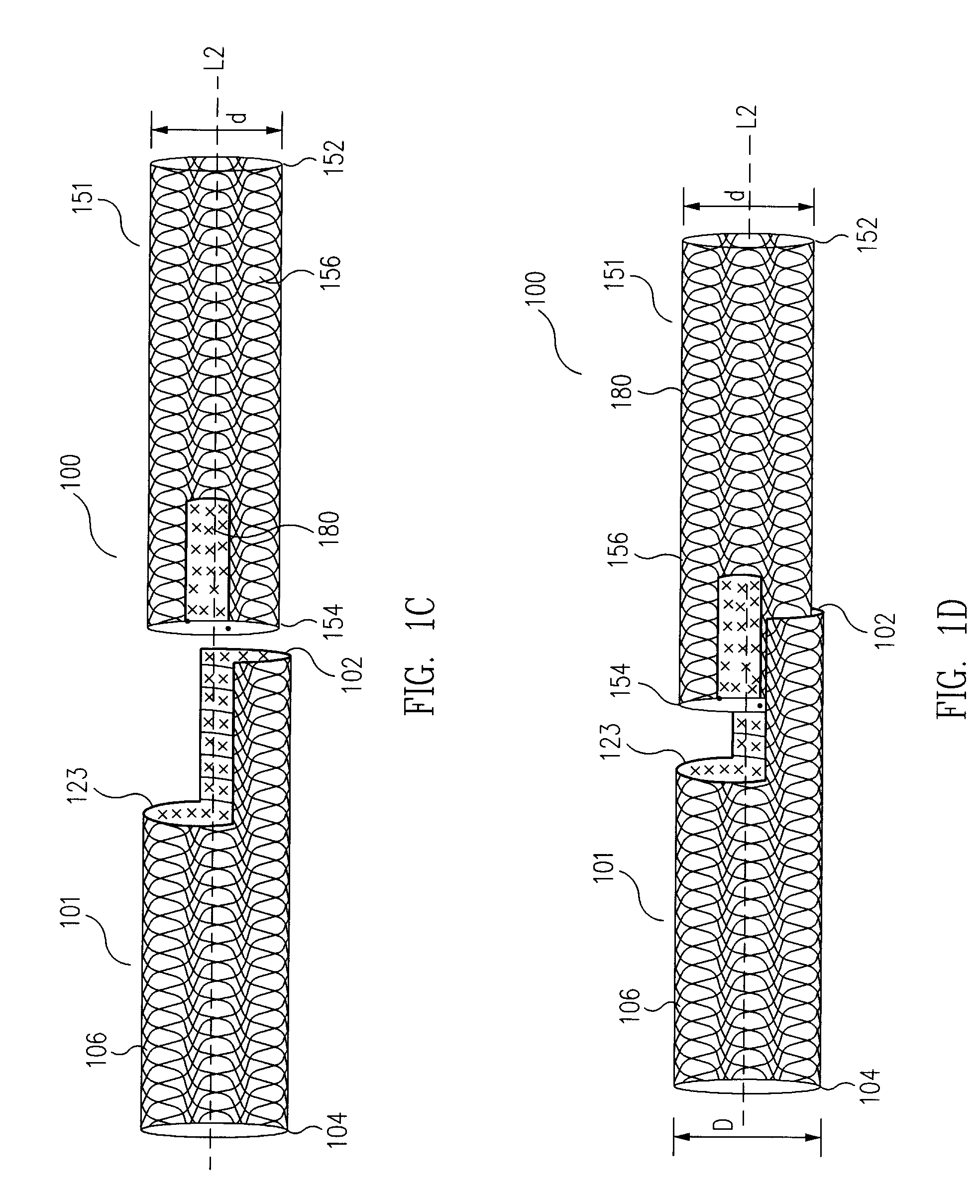 Universal Modular Stent Graft Assembly to Accommodate Flow to Collateral Branches