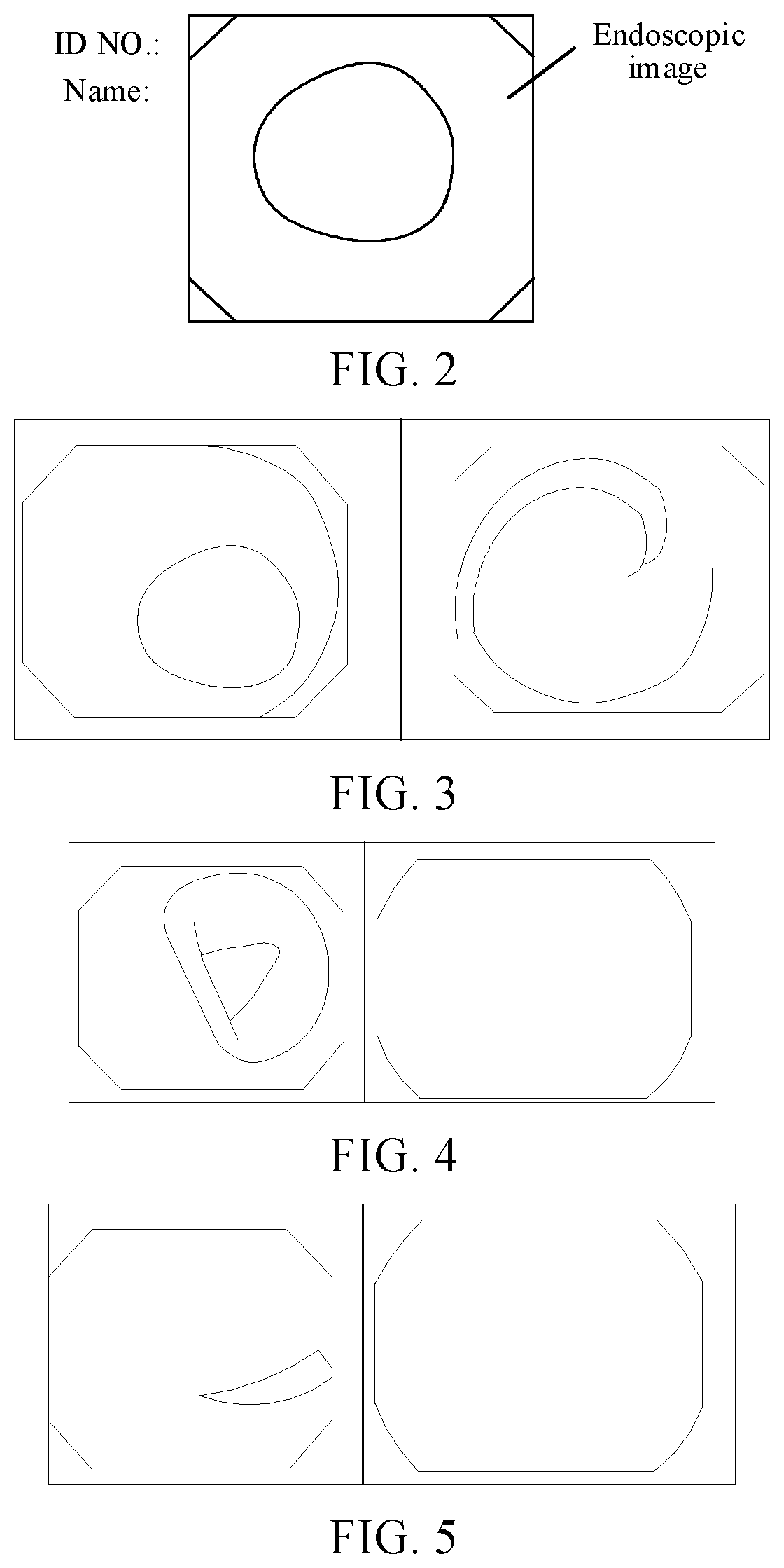 Colon polyp image processing method and apparatus, and system