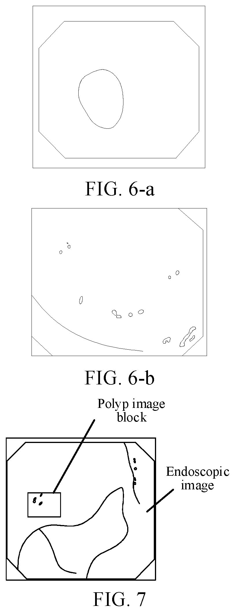 Colon polyp image processing method and apparatus, and system