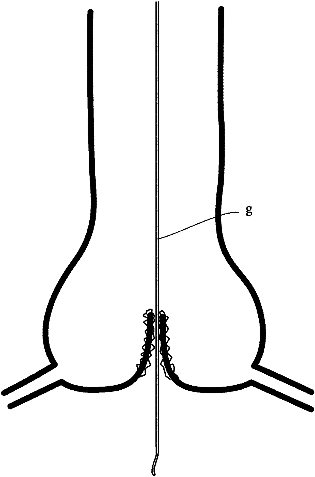 Device for transcatheter insertion into the aortic root at the sinotubular junction