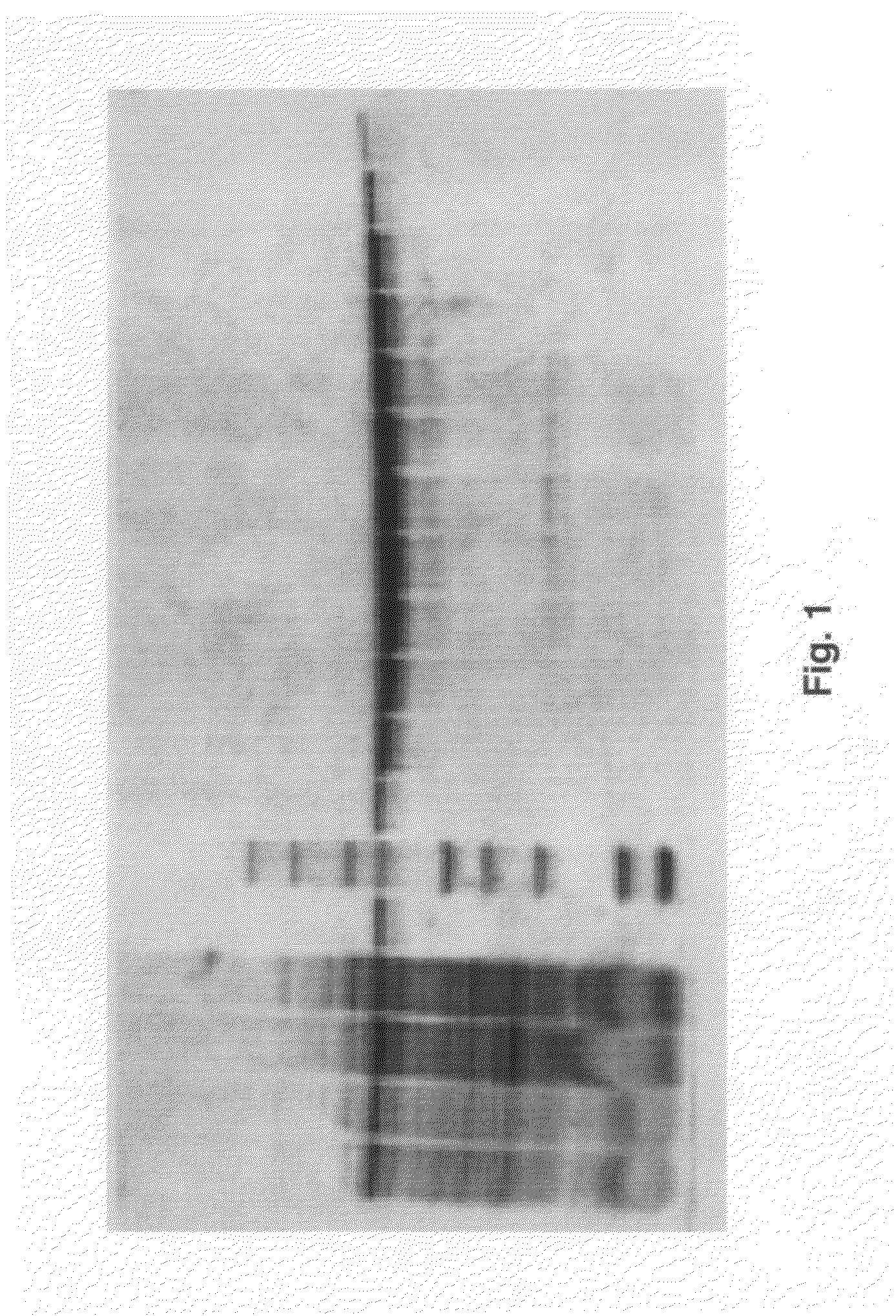 Inhibitors of mycobacterium tuberculosis malate synthase, methods of making and uses thereof