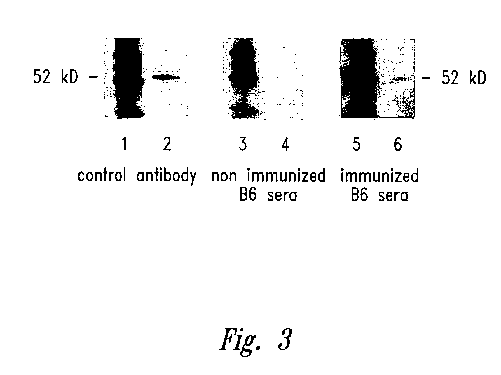 Compositions and methods for WT1 specific immunotherapy