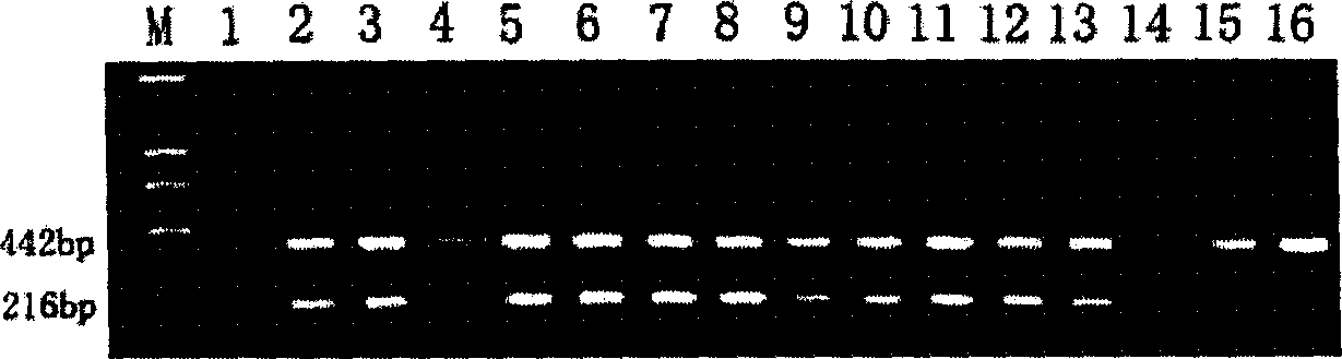 Watermelon anthrax bacteria detecting kit and its detecting method