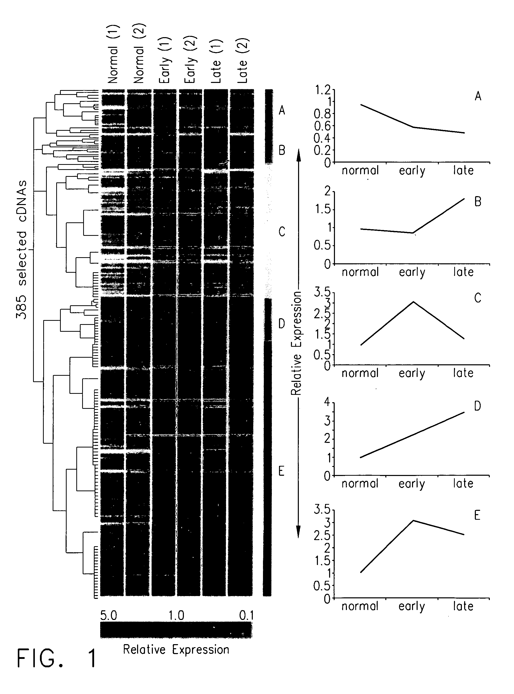 Method for diagnosis and treatment of rheumatoid arthritis