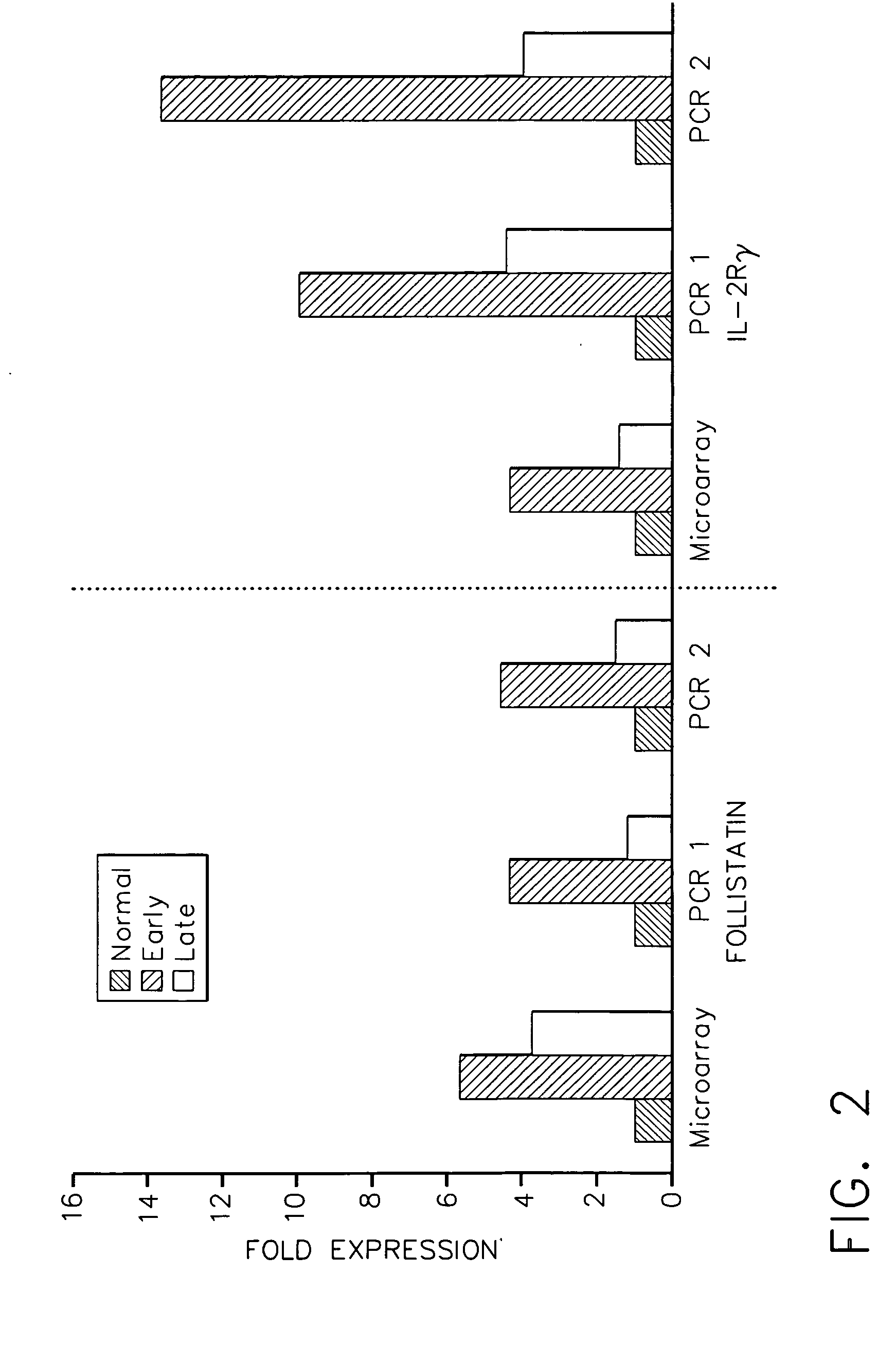 Method for diagnosis and treatment of rheumatoid arthritis