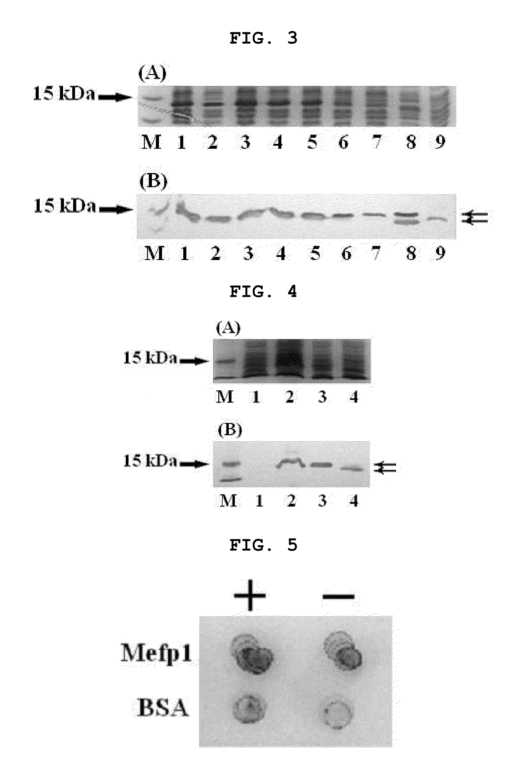 Production of a soluble native form of recombinant protein by the signal sequence and secretional enhancer