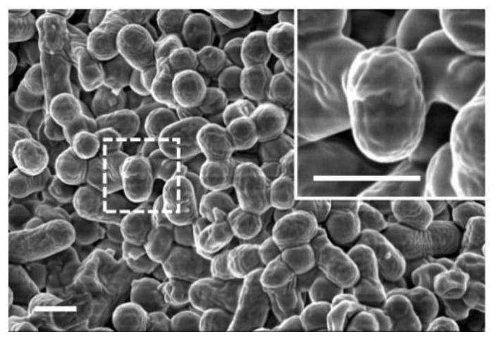 Application and method of blue light activation of (s)-blebbistatin molecule to kill drug-resistant Acinetobacter baumannii