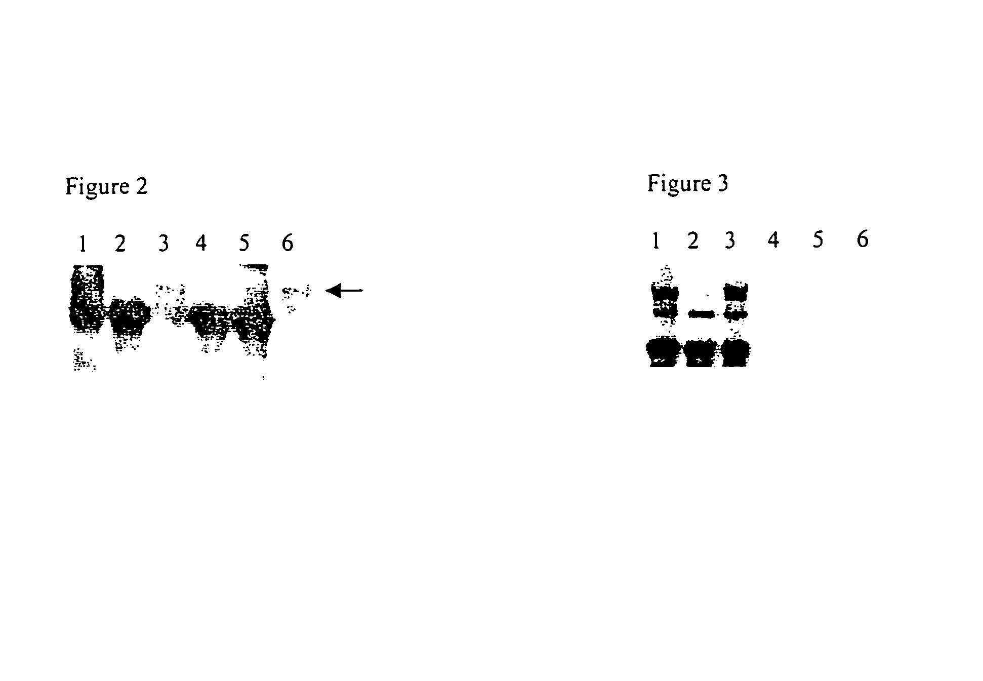 Derivatives of the IL-2 receptor gamma chain, their production and use