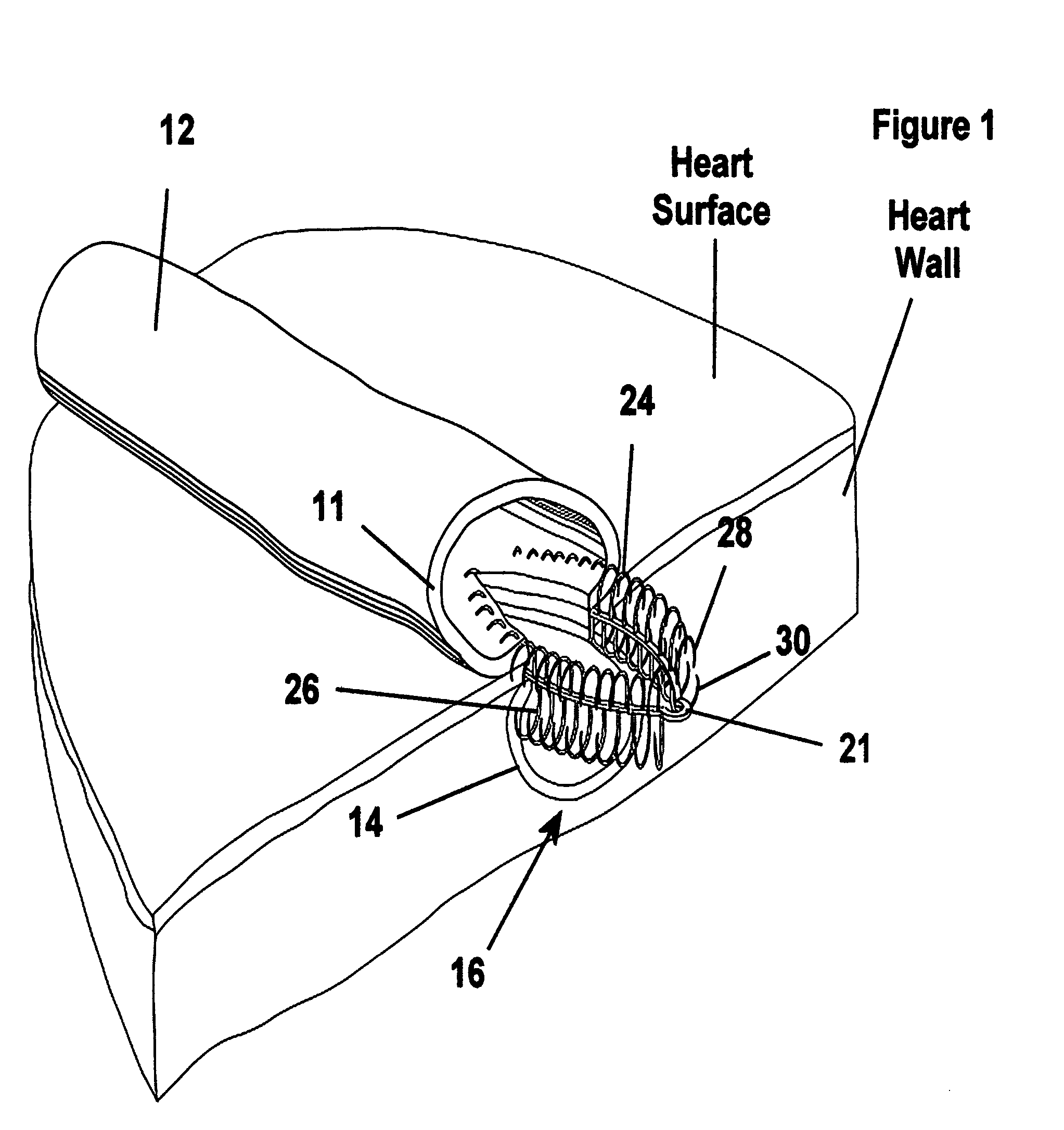 Fastener apparatus for tissue and methods of deployment and manufacture