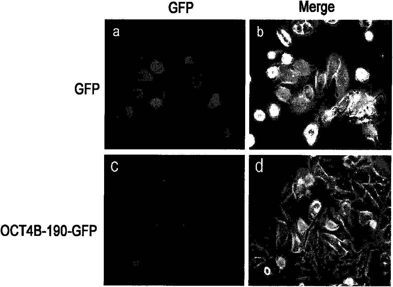 Protein related to cell stress, and coding gene and application thereof