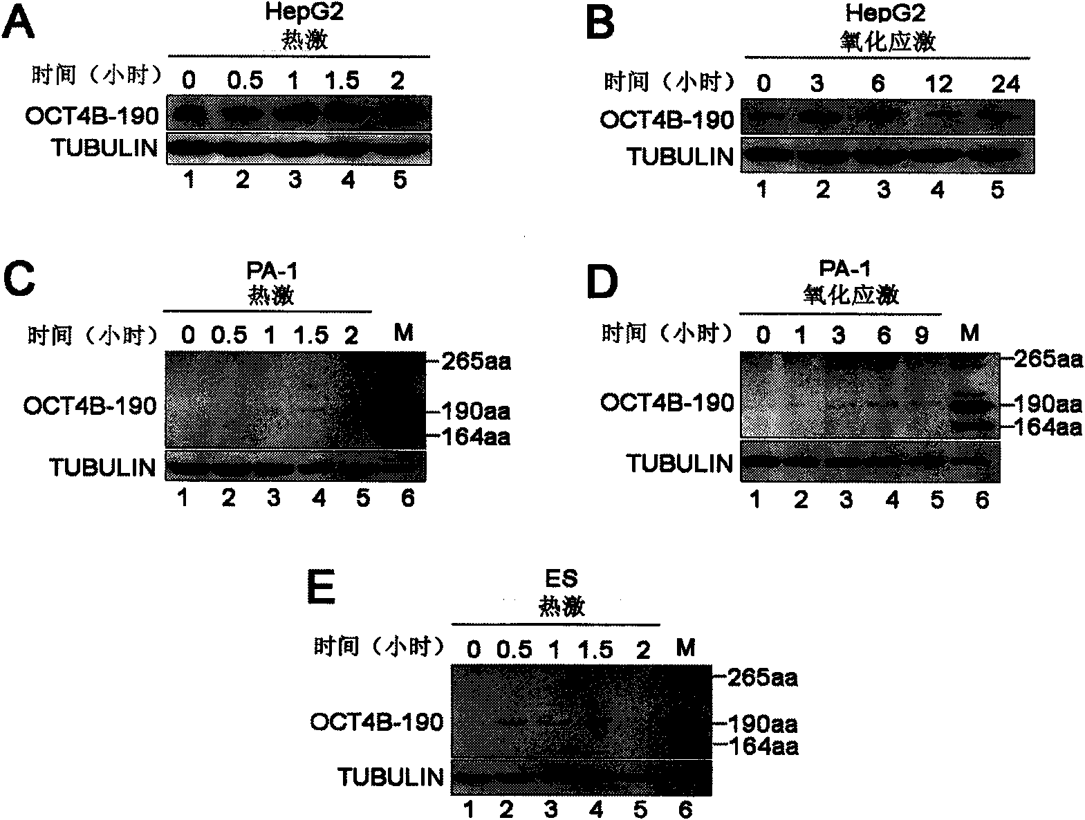 Protein related to cell stress, and coding gene and application thereof