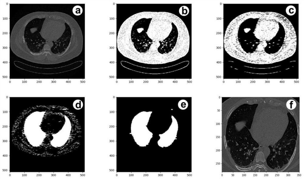 Multi-class pneumonia screening deep learning device based on CT images