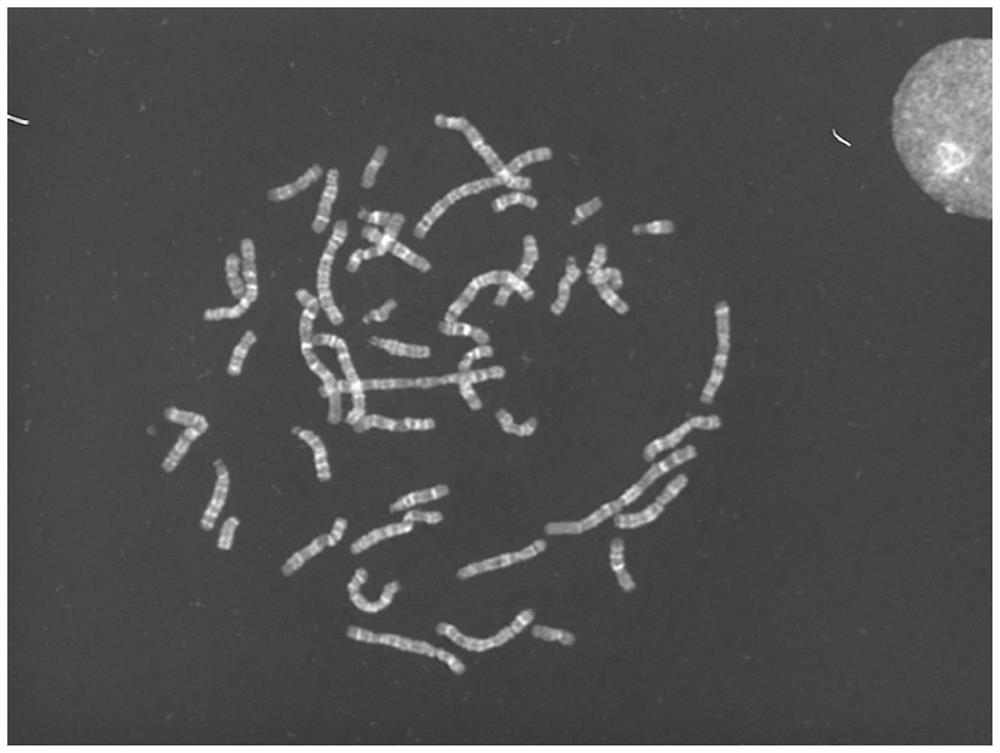 Deep learning-based karyotype analysis method and system