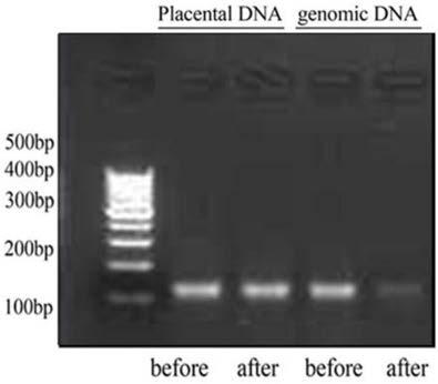 Kit and method for concentrating fetal free DNA, and application of kit