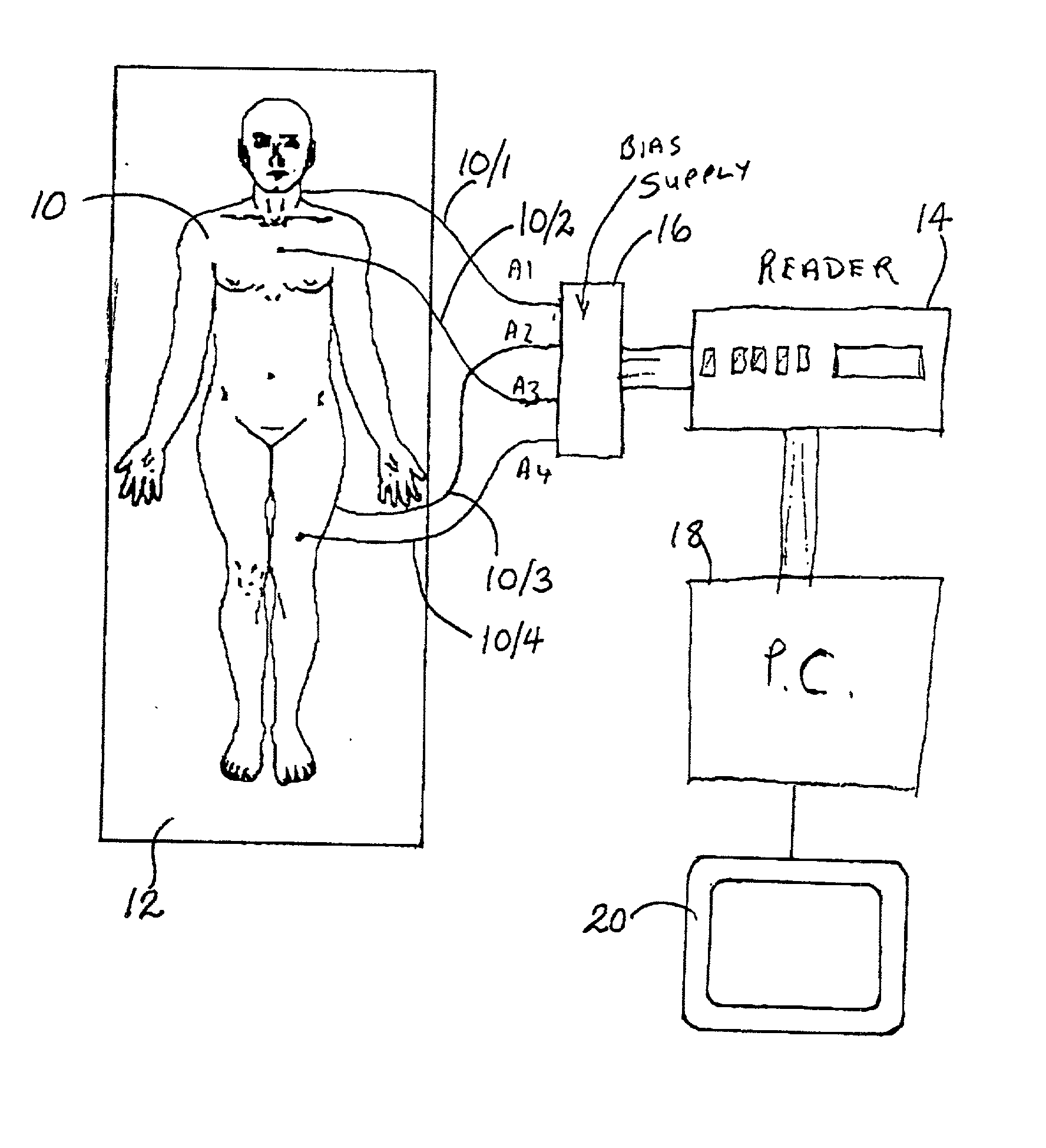 Computer assisted radiotherapy dosimeter system and a method therefor
