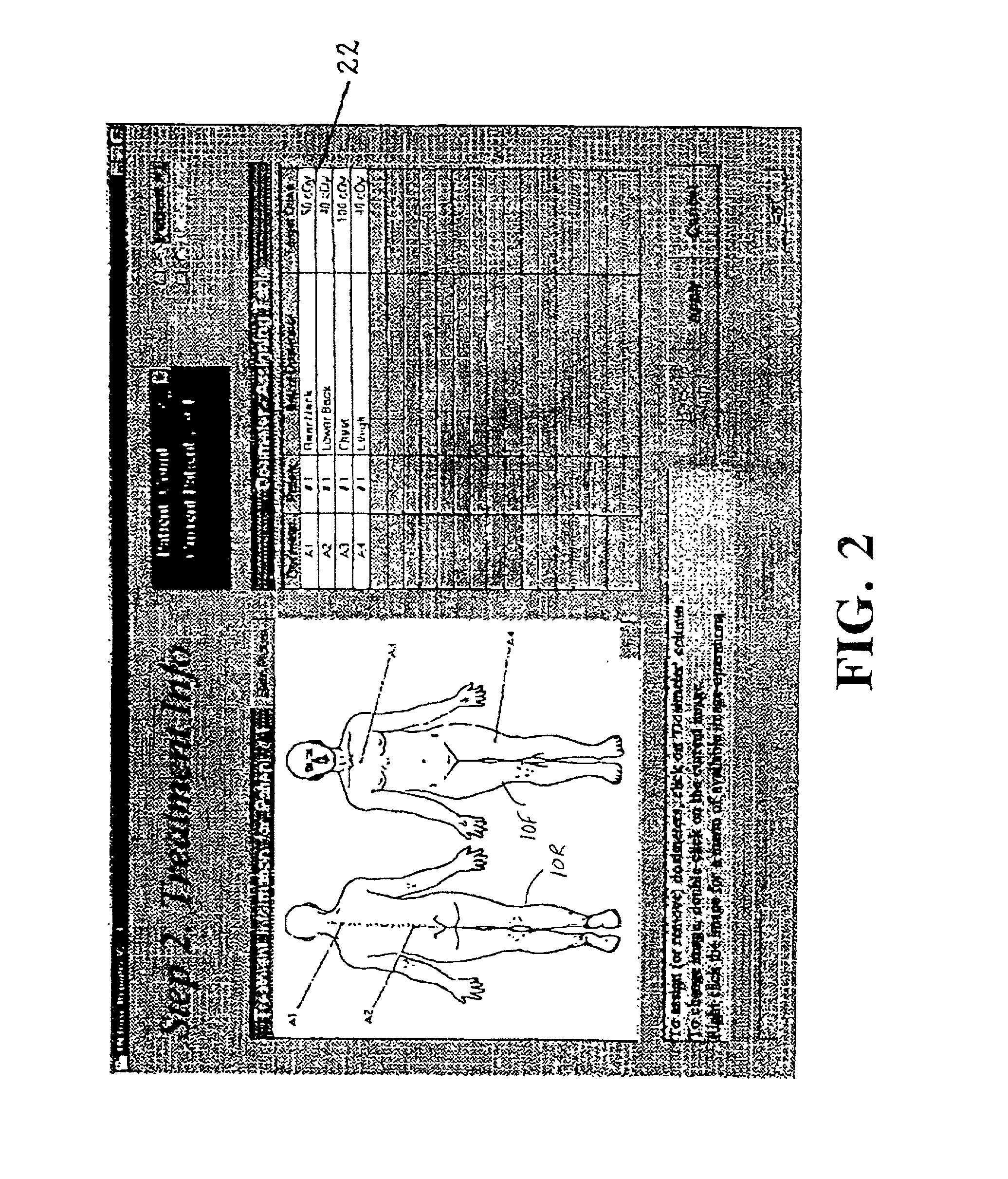 Computer assisted radiotherapy dosimeter system and a method therefor