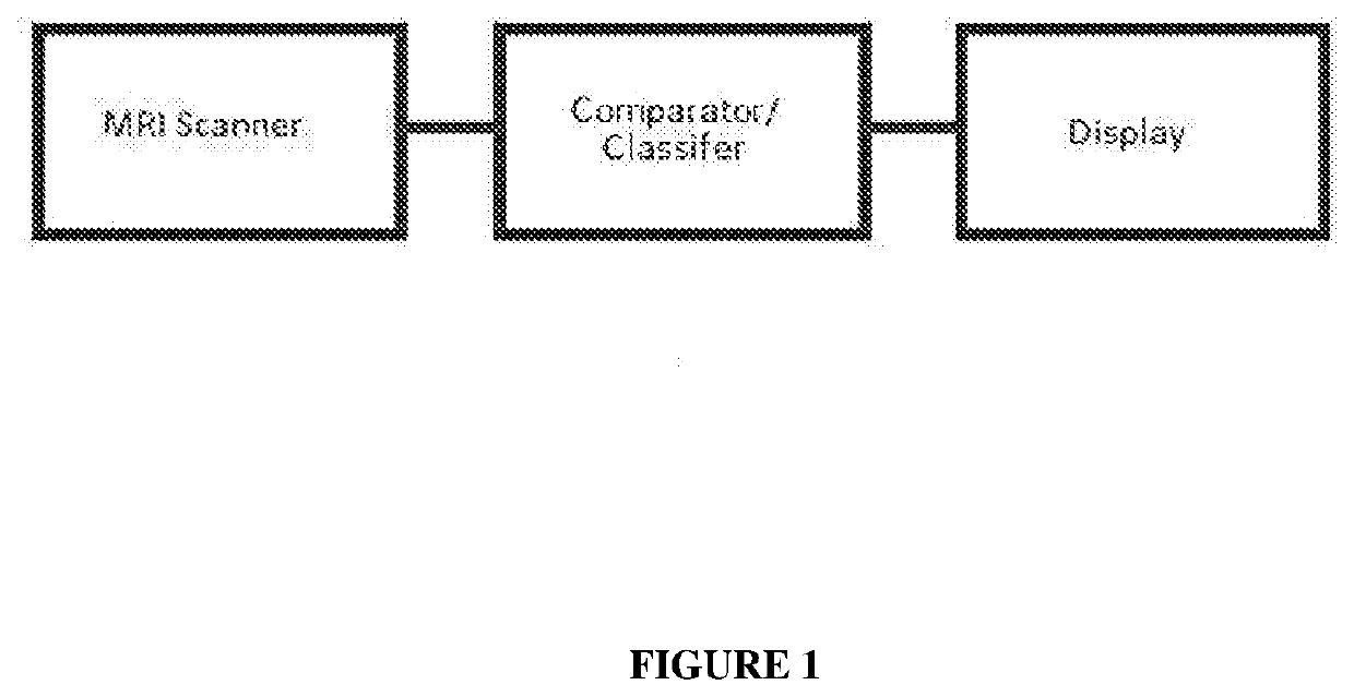 Method and system for detecting and identifying acute stress response from traumatic exposure, its transition to post traumatic stress disorder, and monitoring subsequent therapy