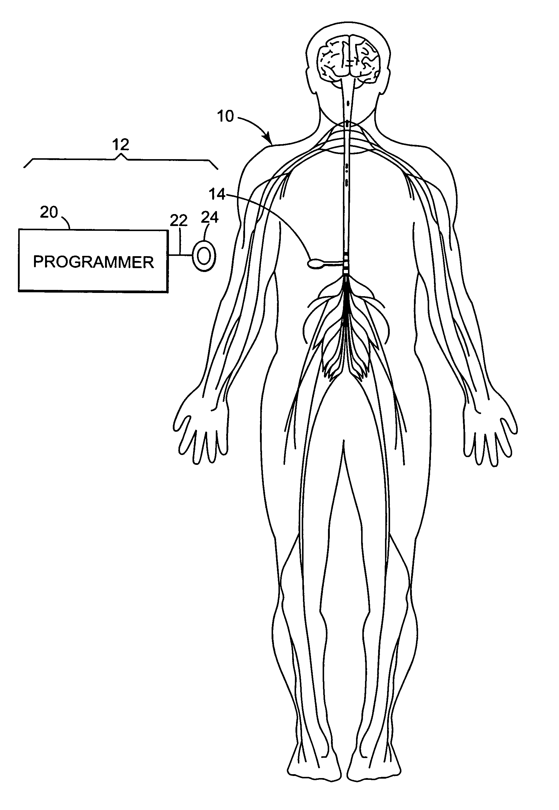Method of delivering a fluid medication to a patient in flex mode