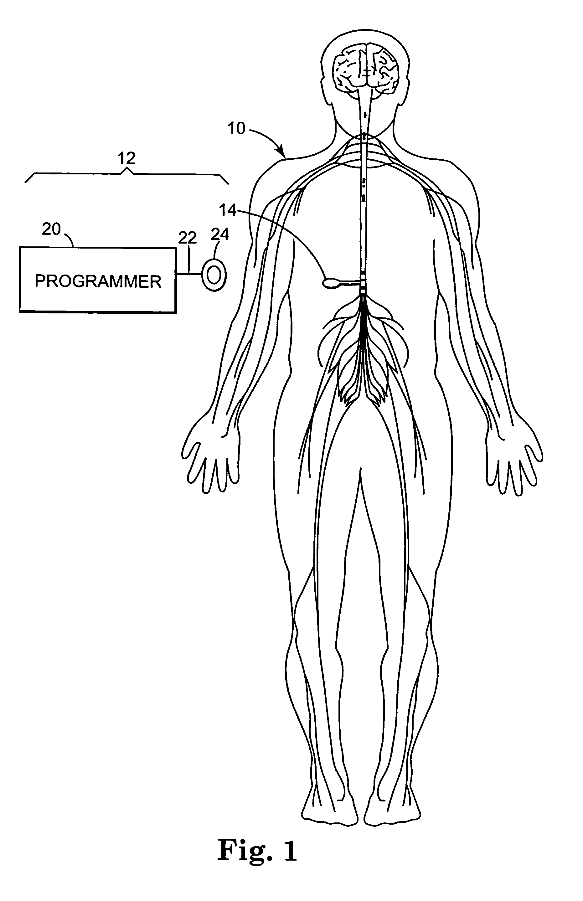 Method of delivering a fluid medication to a patient in flex mode