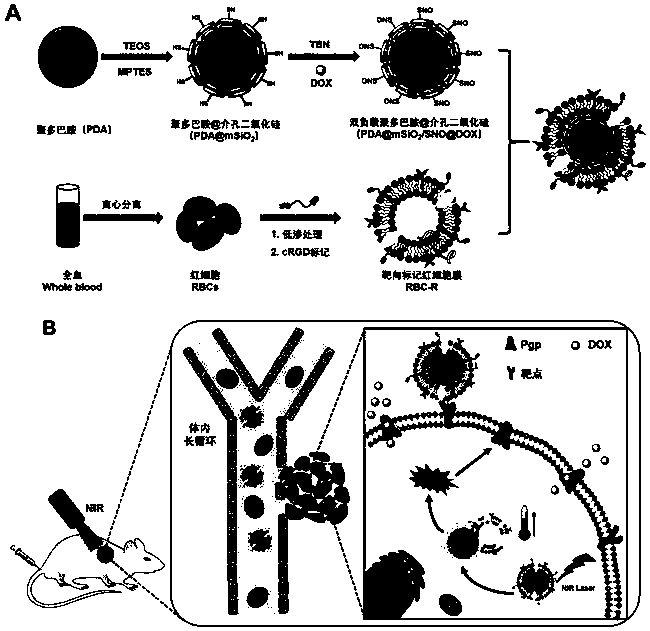 Preparation and application of light-triggered erythrocyte membrane wrapped NO nano bionic donor material